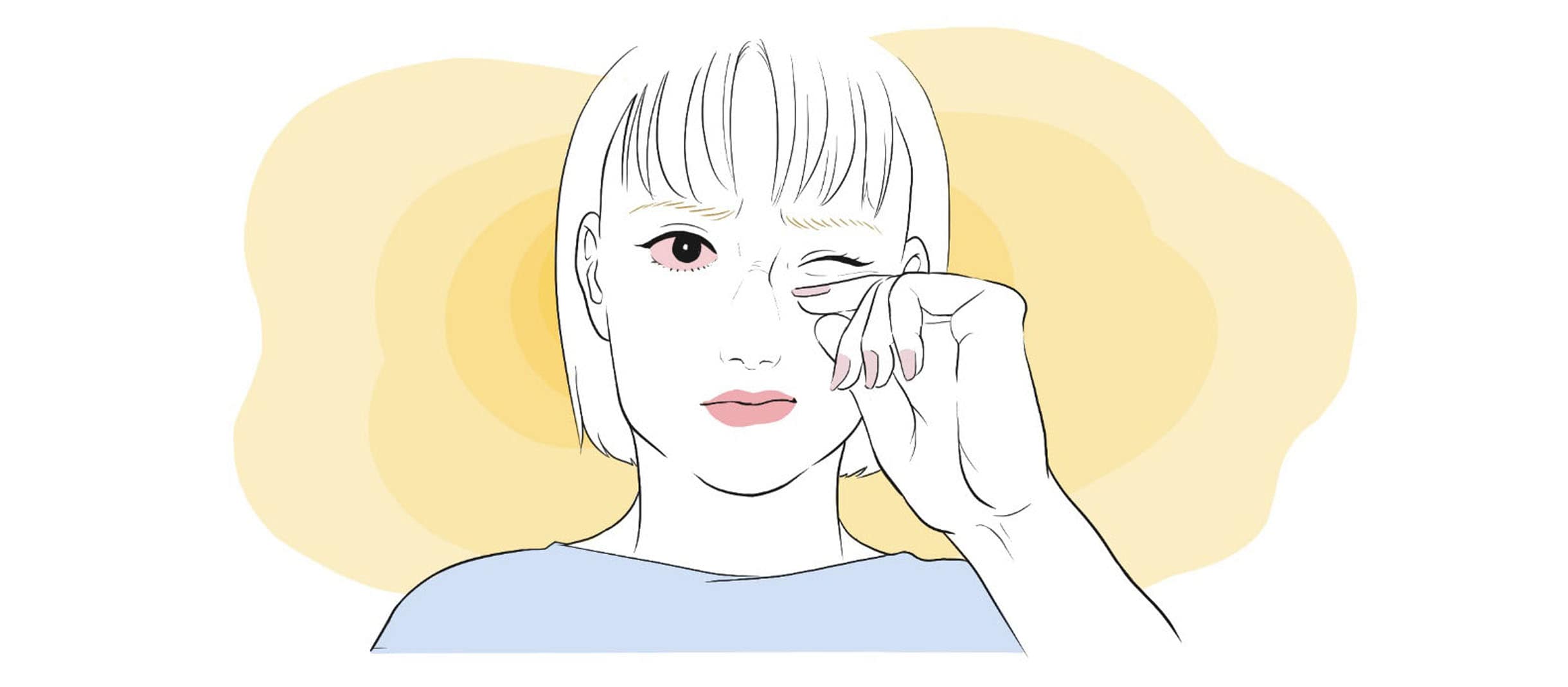 コンタクトレンズで目が充血したらどうする？原因や対処法を紹介